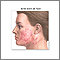Skin smoothing surgery  - series
