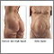 Liposuction - series Liposuction - series
